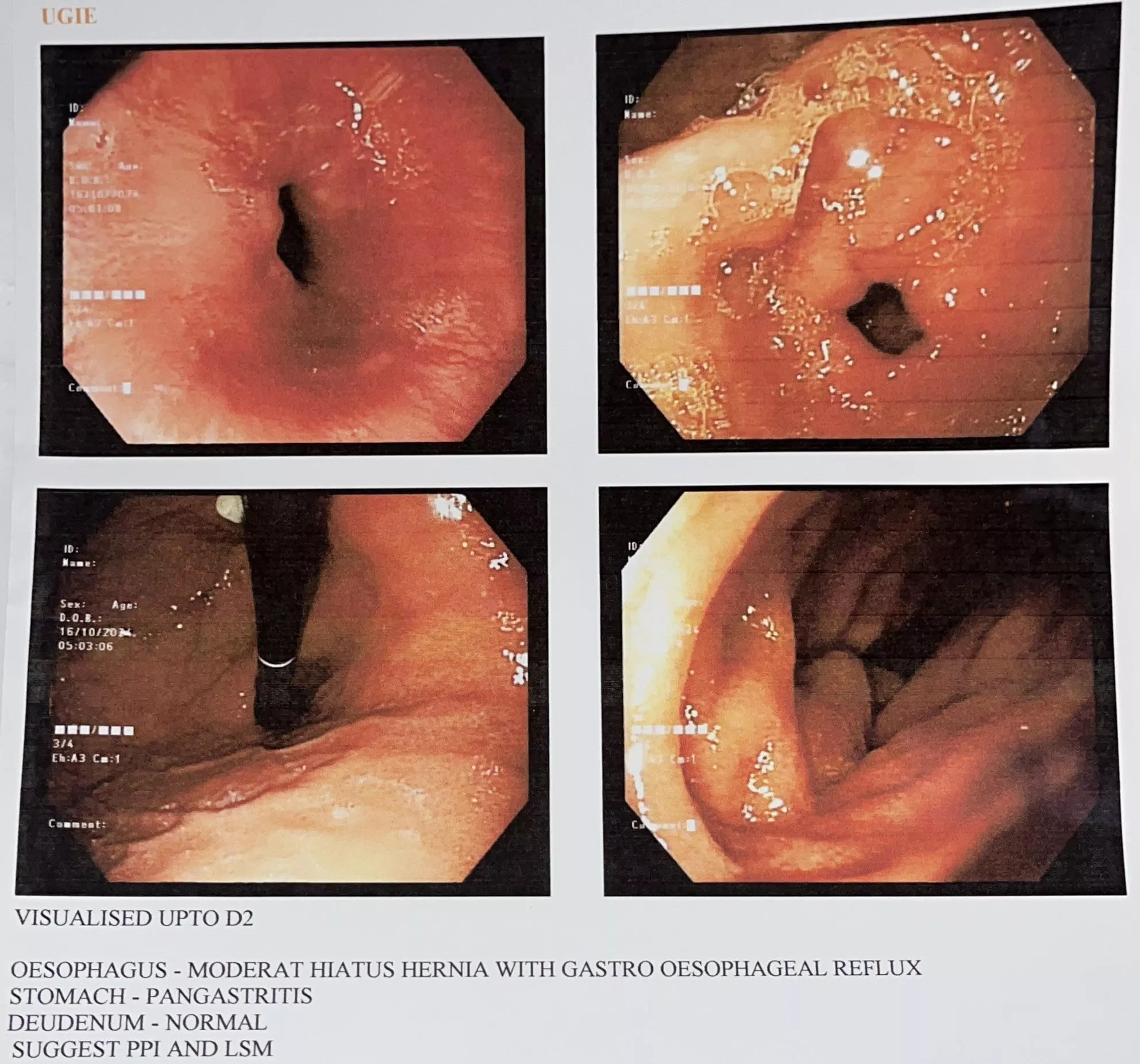 Does my diagnosis go along with the endoscopy images?