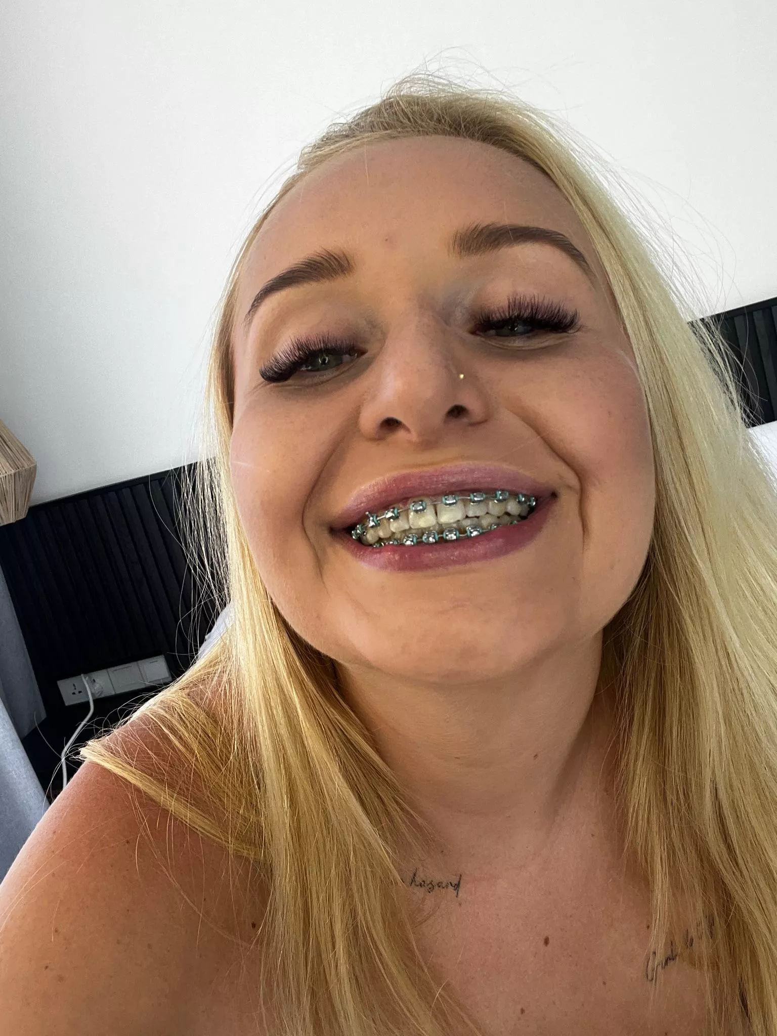 Getting hard looking at the metal on my teeth ?