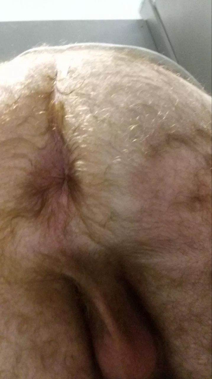 Hairy and rate