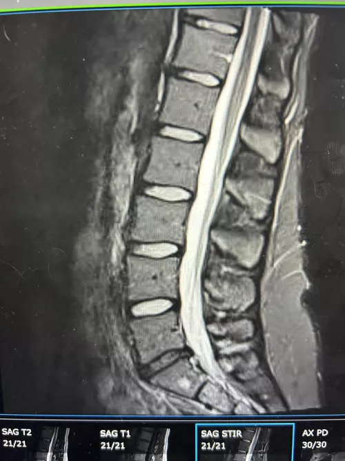 Is my weight gain why my back hurts so bad?