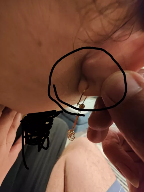 Is this a cyst or lymph node?? 