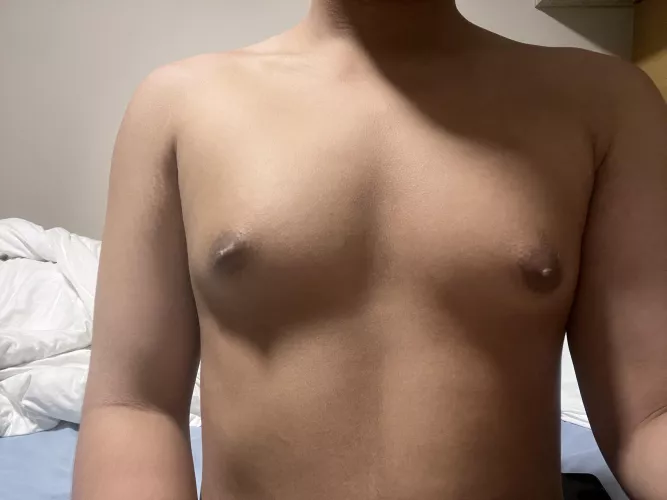 Just restarted a 2 weeks ago with injections but I have been on estrogen a total of ~1 year and 1 month