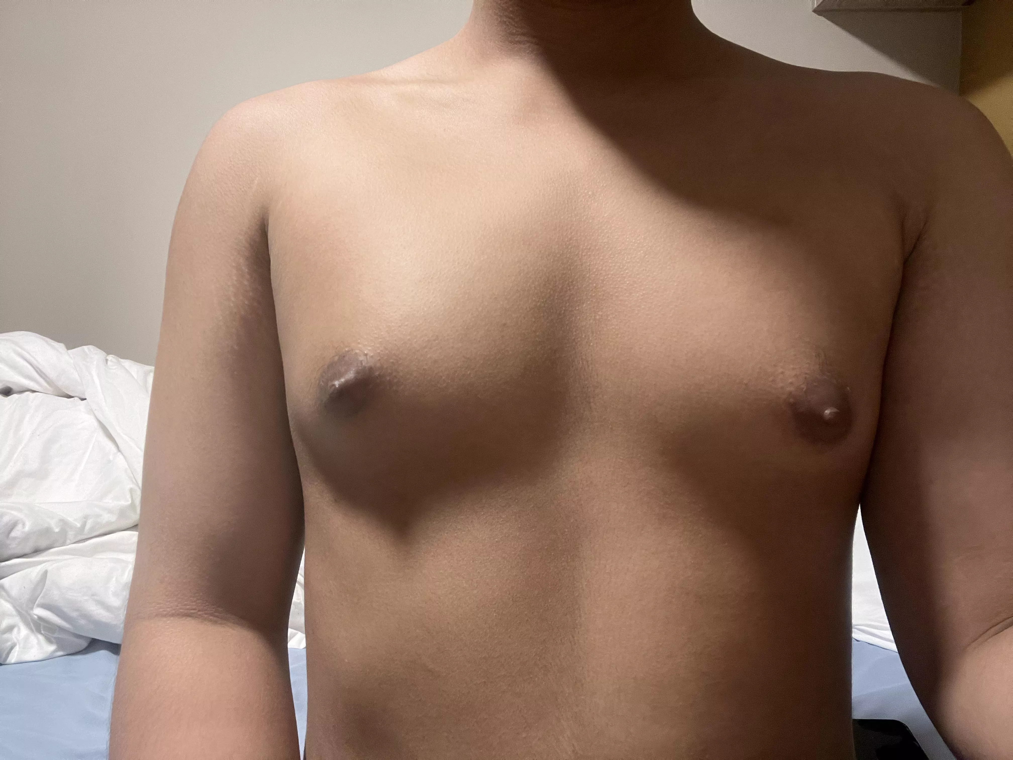 Just restarted a 2 weeks ago with injections but I have been on estrogen a total of ~1 year and 1 month