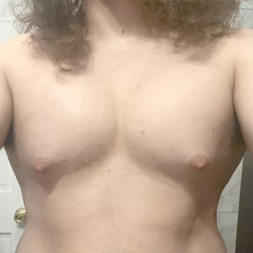 Looking to start HRT soon (22m), do I already have gyno / man boobs from being overweight, or are these pectorals?