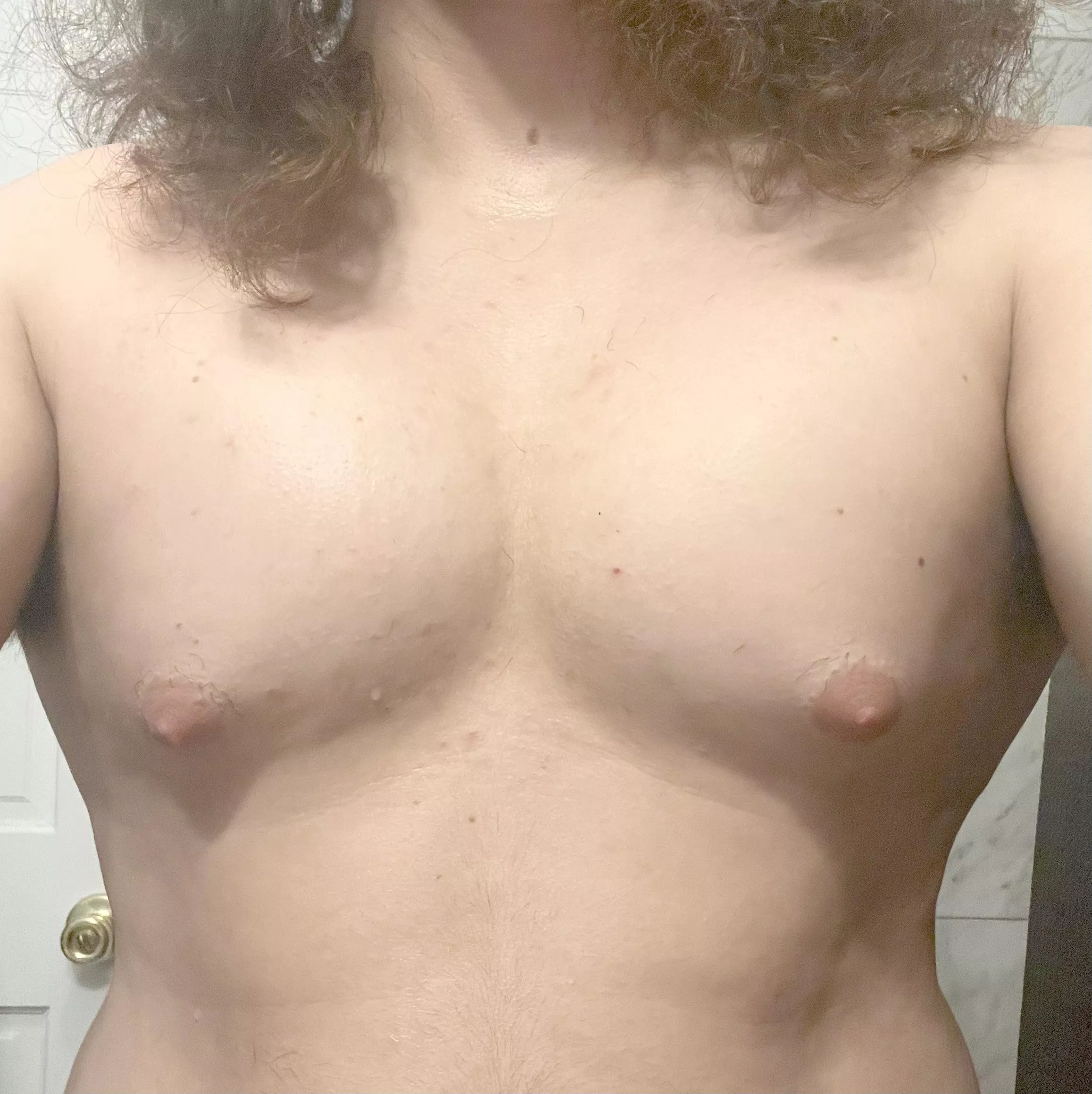 Looking to start HRT soon (22m), do I already have gyno / man boobs from being overweight, or are these pectorals?