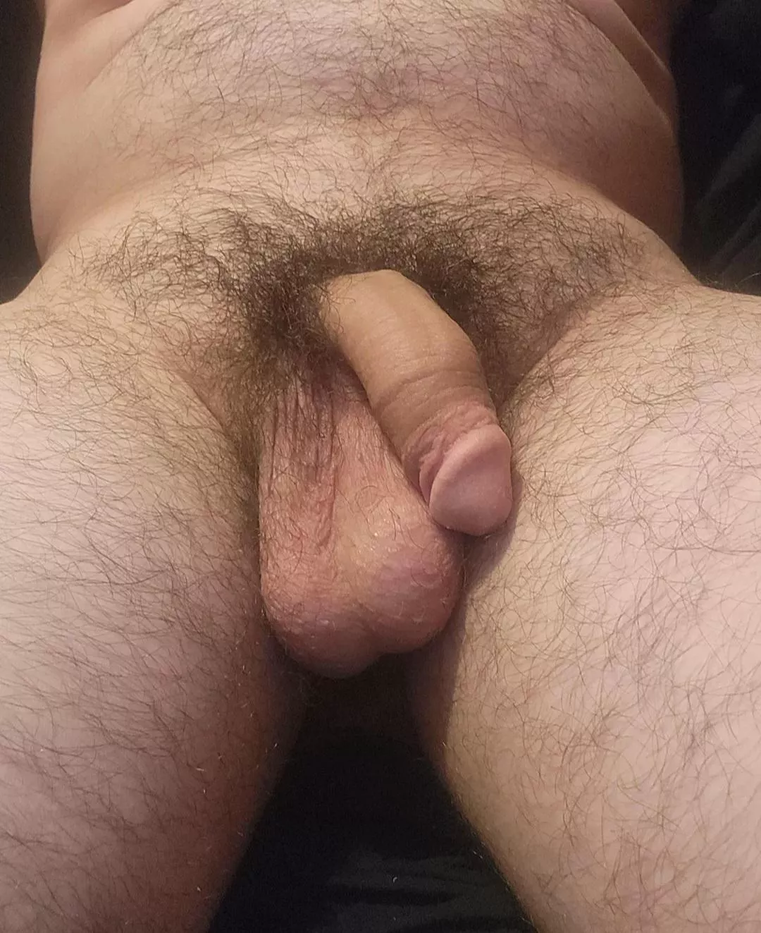 My balls are swollen