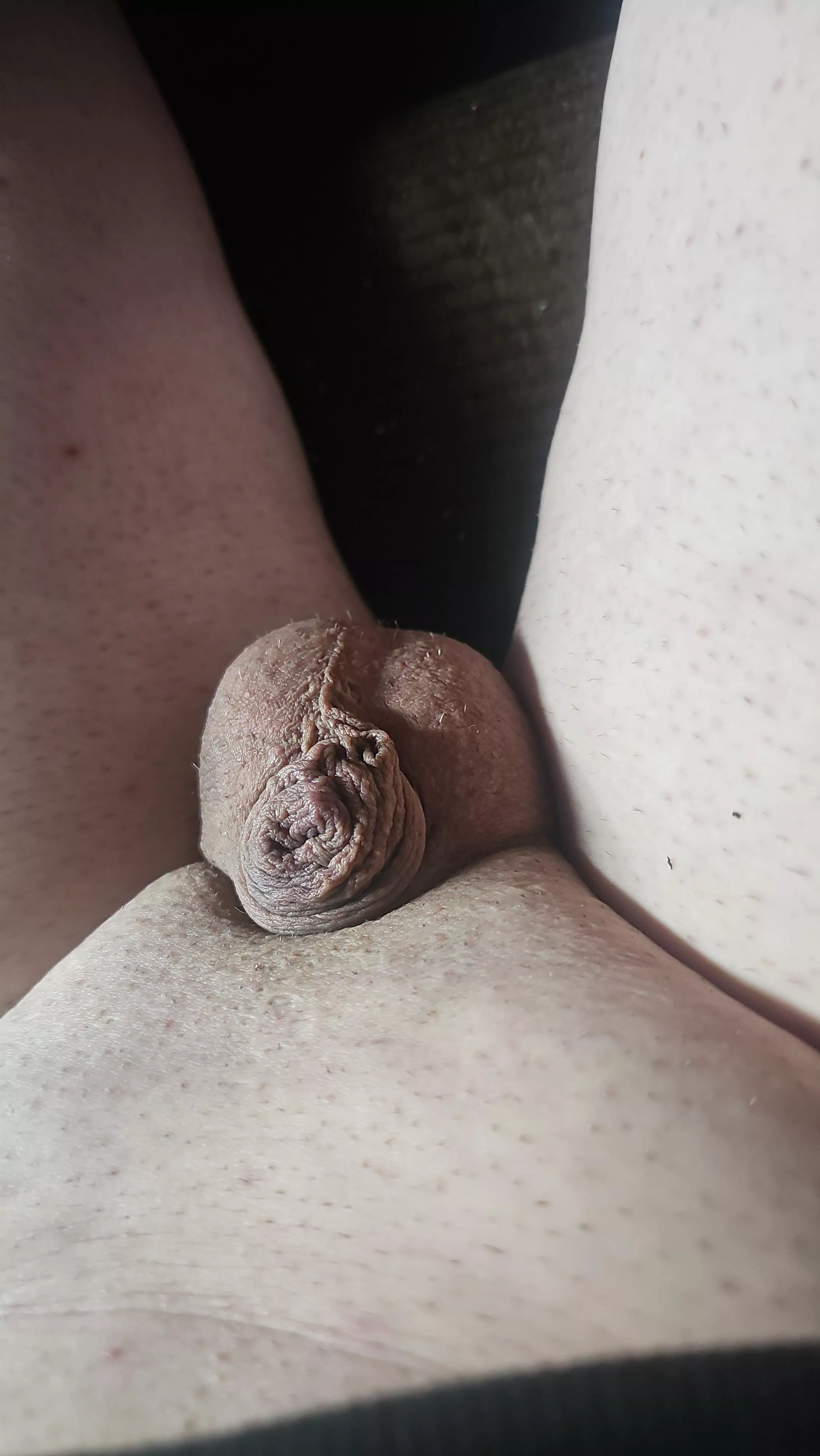 My T is so low, it atrophied now it's fully inside