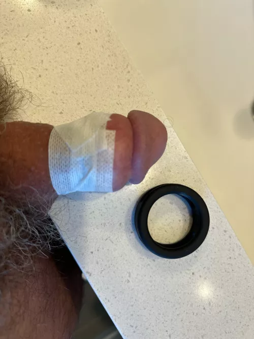 Reverse taping for travel