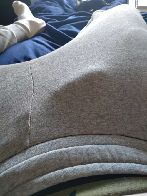 Too noticeable to go out with?