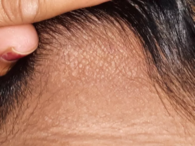 White spots like on backside of head