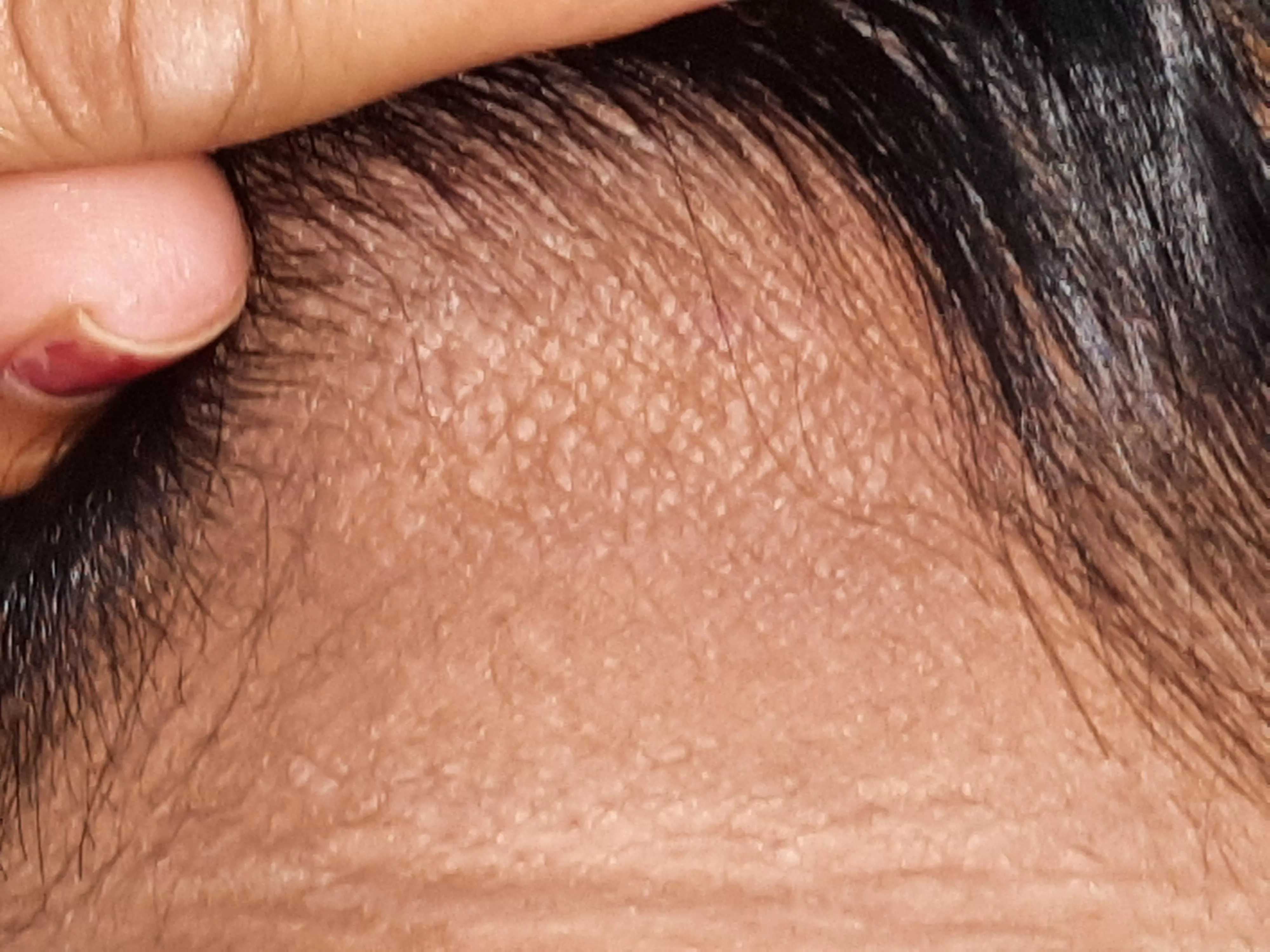 White spots like on backside of head