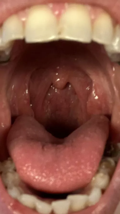 Who wants to swim in my tummy? 