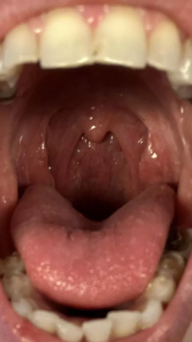 Who wants to swim in my tummy? 