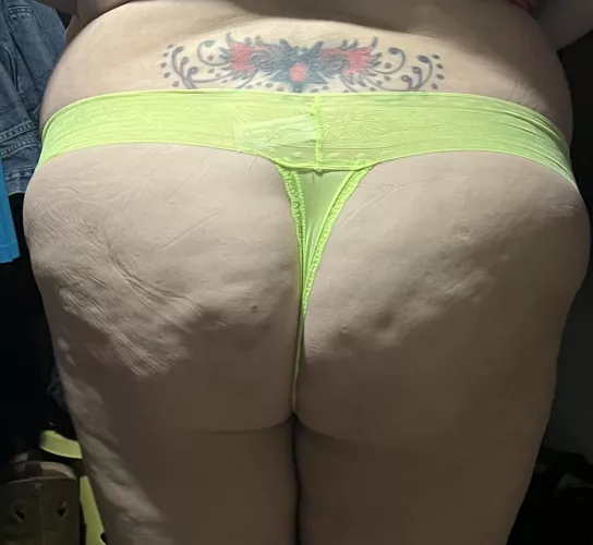 Cellulite showing today