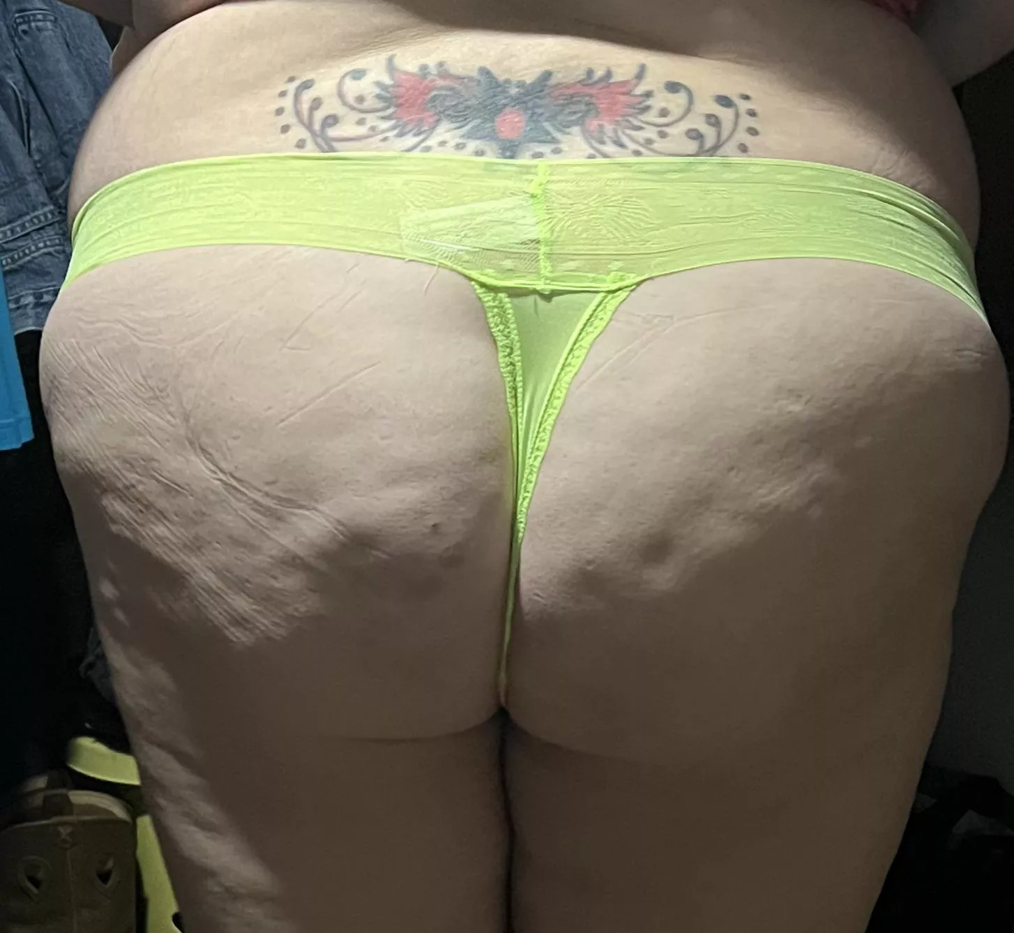 Cellulite showing today