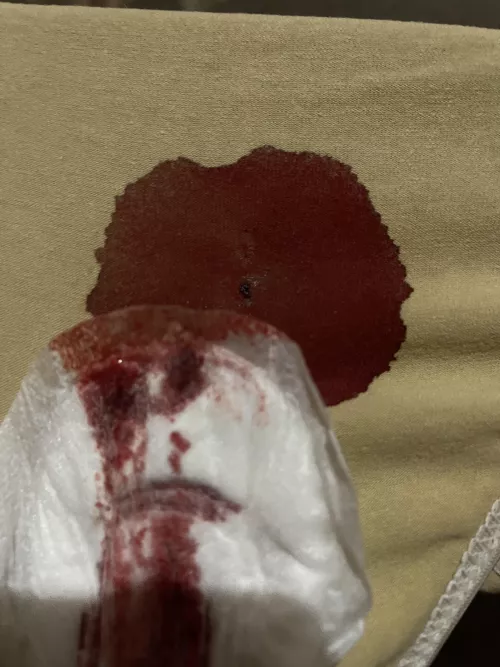 Day 2 started out intense... we'll see how much my wipe can handle.. 