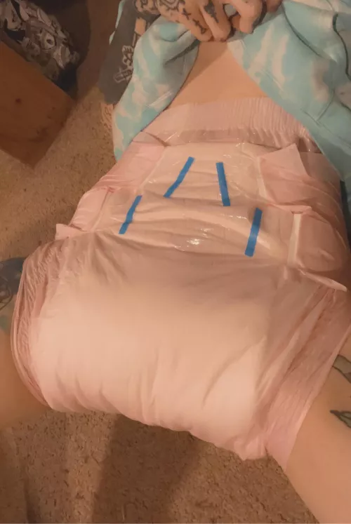 Even When My Health Gets Bad and I’ve Got a Catheter In, I Still Stay Padded 🍼✨