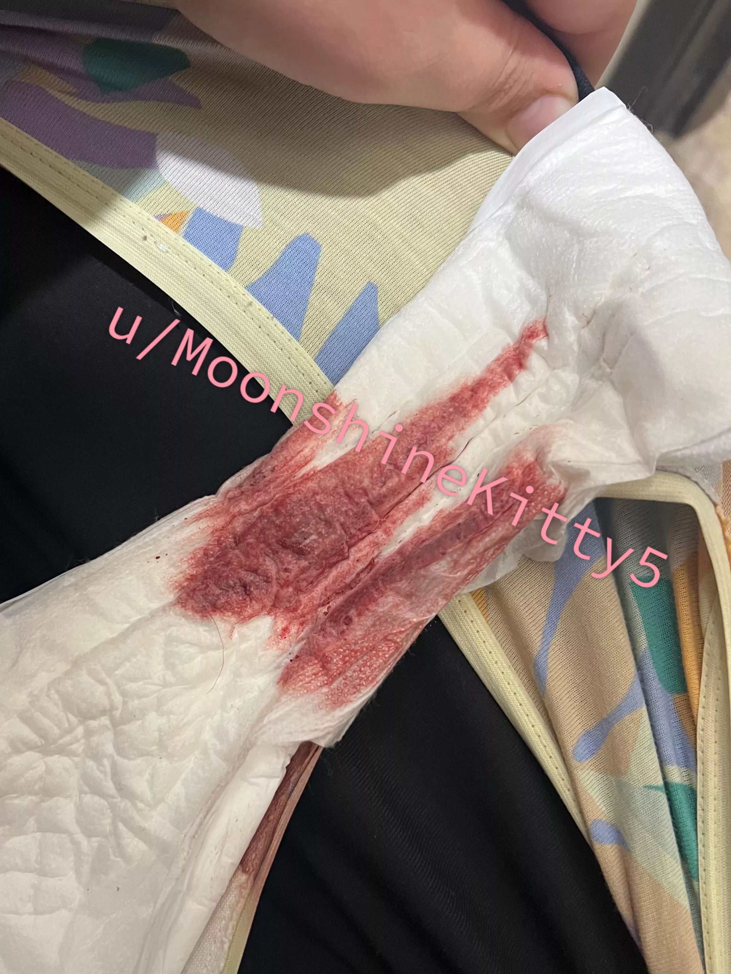 It’s only getting better from here 