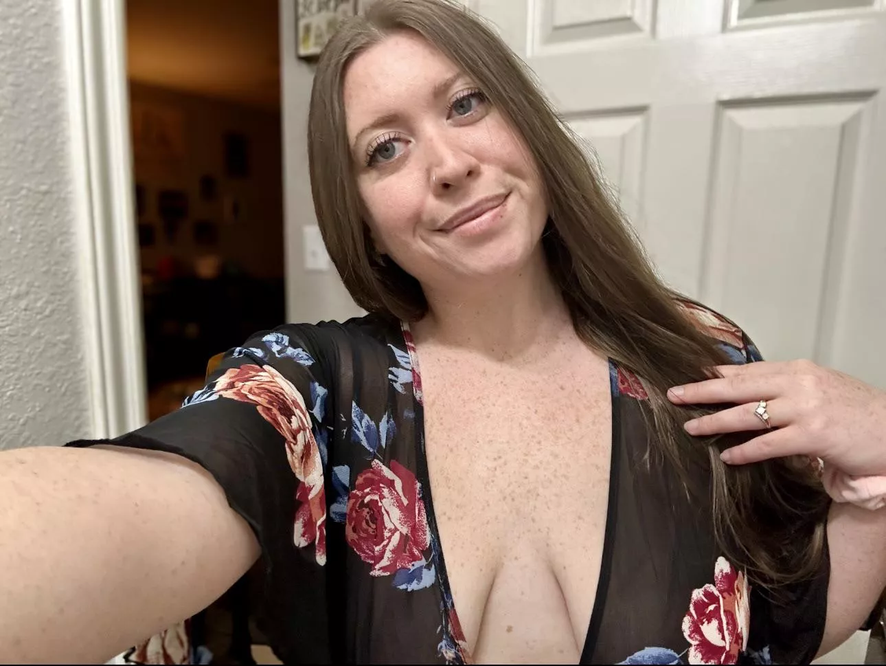 My eyes are up here. My freckles are everywhere 😉