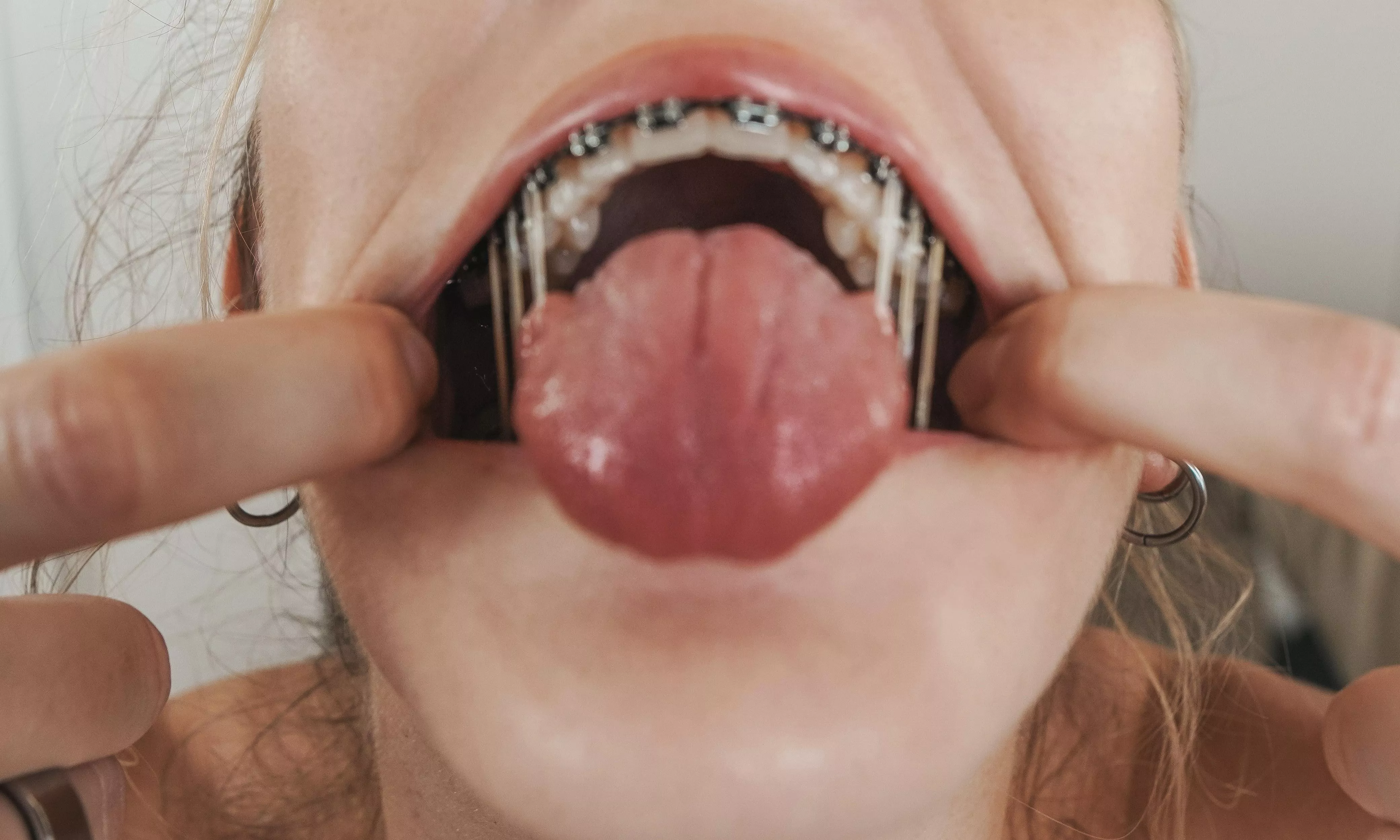 Try not snap my elastics because that really hurts