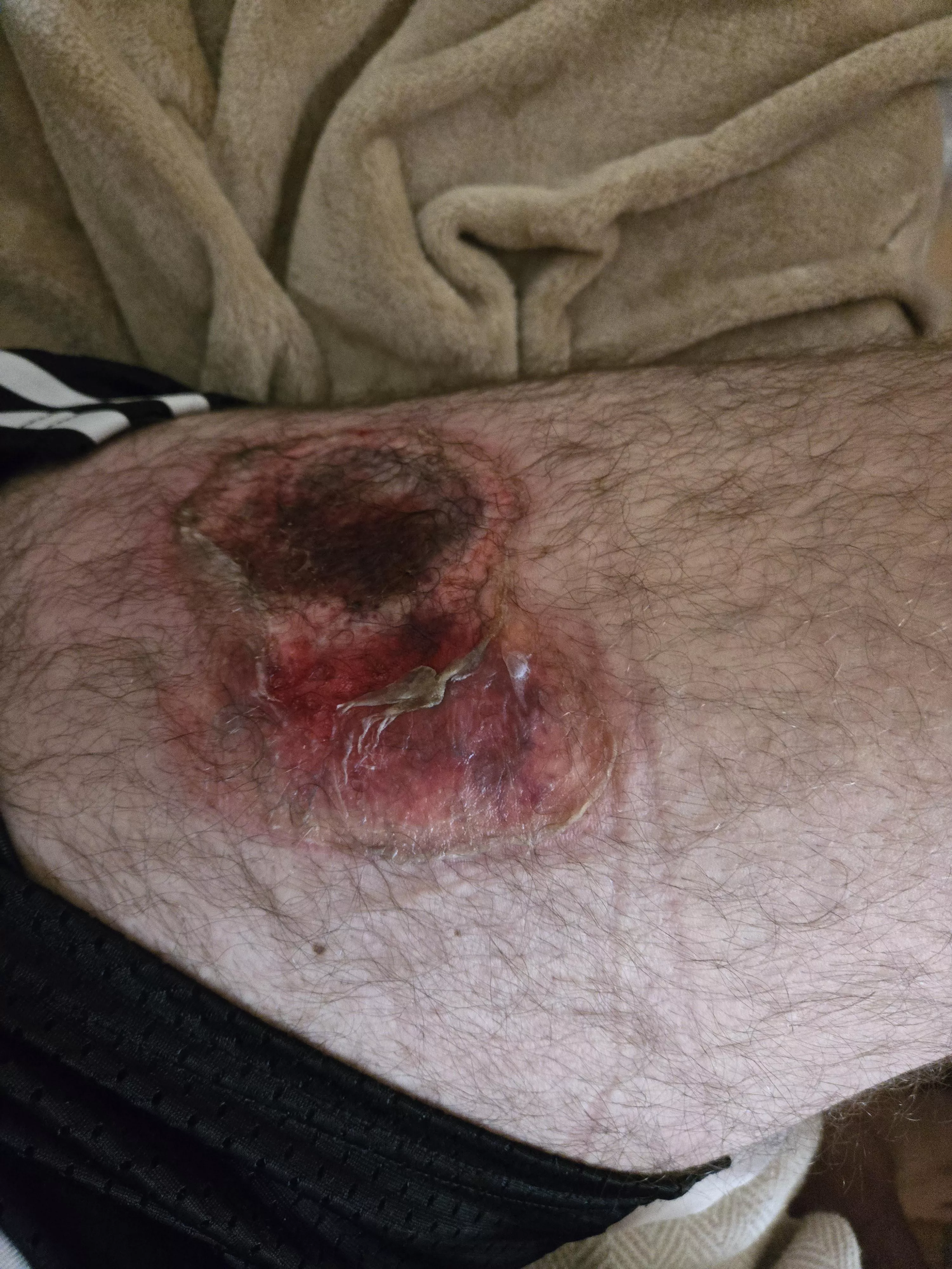 want to see an awesome nitrous strory