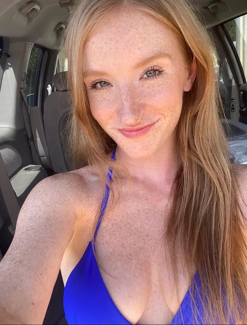 Are freckles on a redhead sexy 