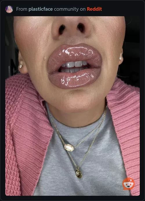 Glam shiny huge lips