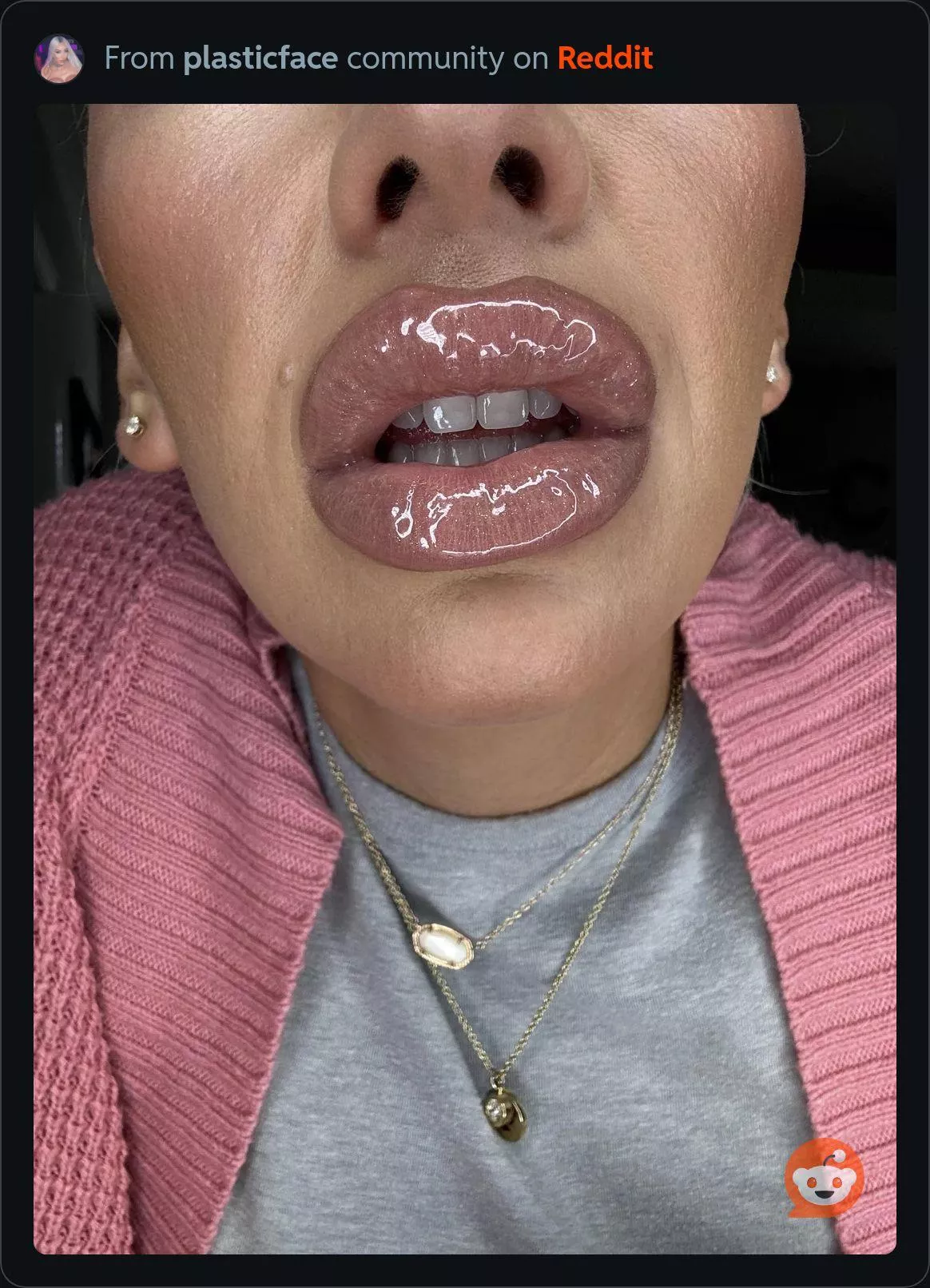 Glam shiny huge lips