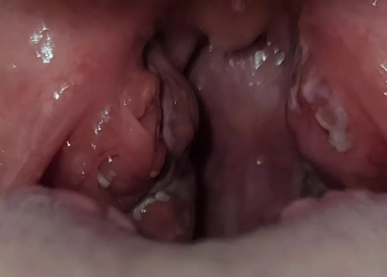 My balls hurt, my mouth balls