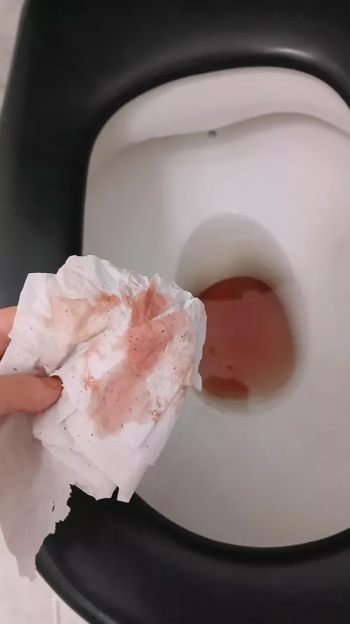 Wednesday surprise. My period came in abundance