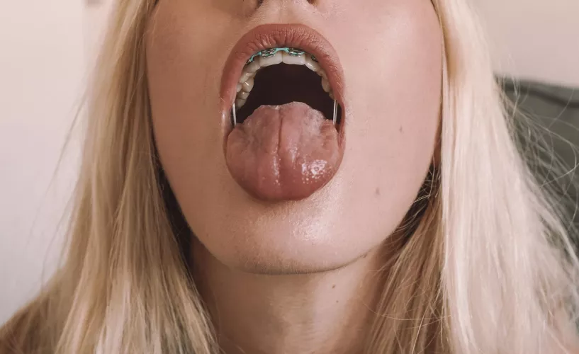 Would you aim for my braces, or cover my whole face?