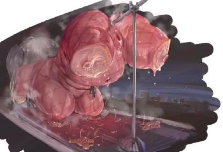 Would you like some roast beef?