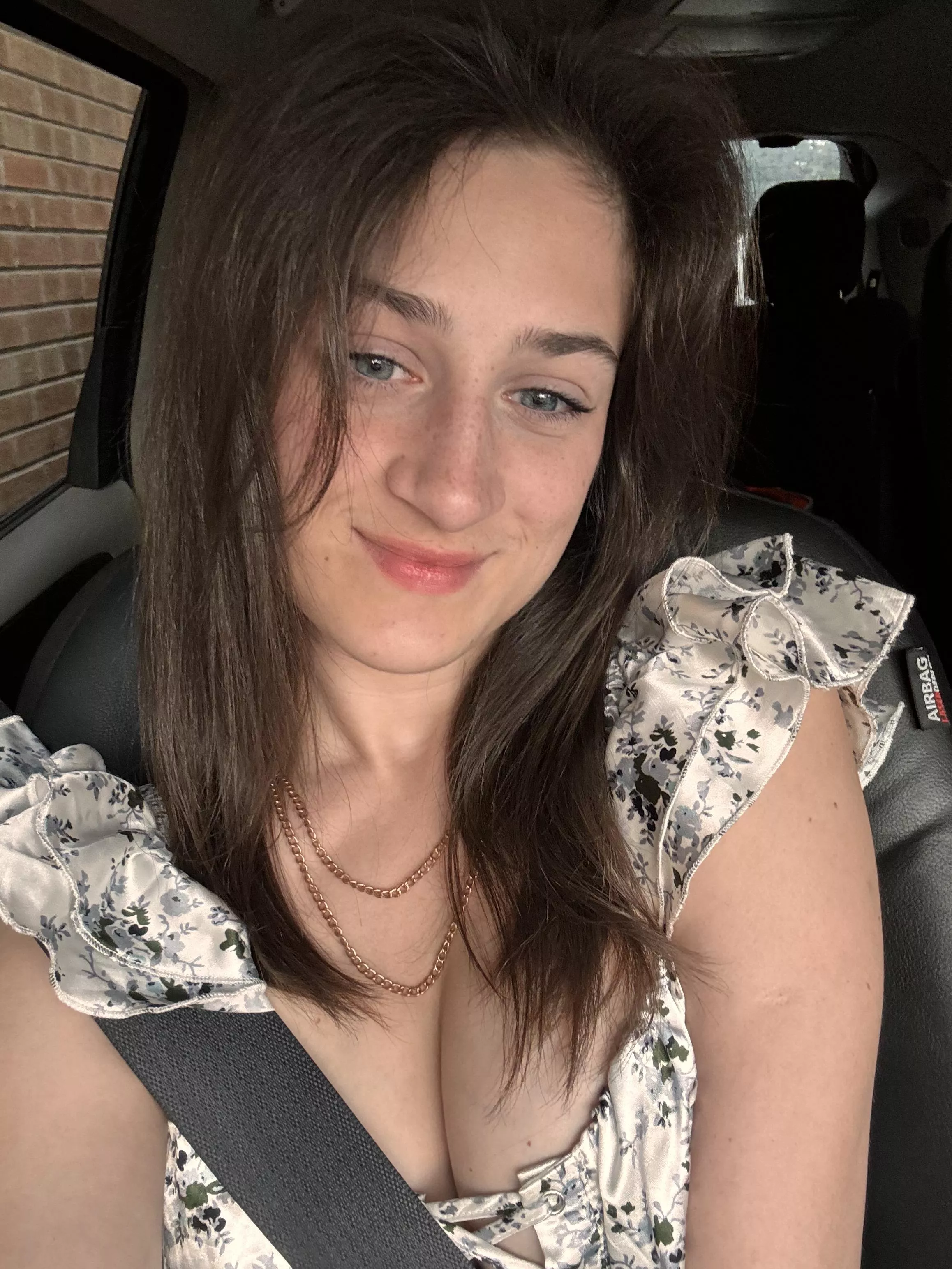 Do I have to many freckles