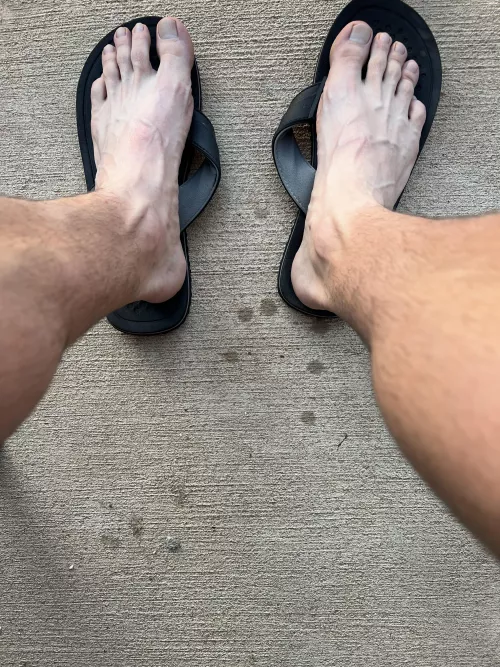 Do my feet look weird?