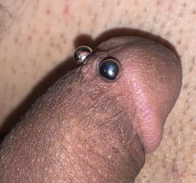 The first frenum almost 2 years ago.