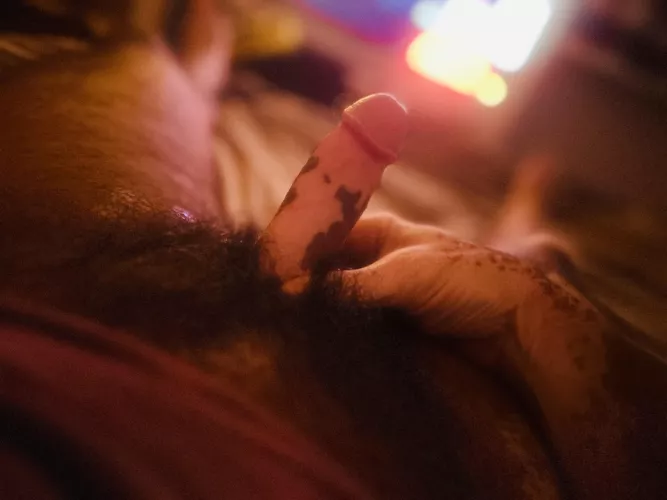 Vitiligo too , dm to chat m4m