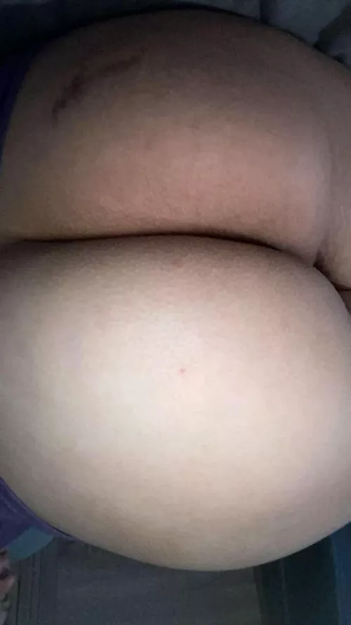 What do you think of my white booty😜