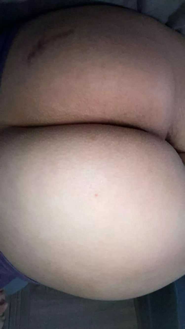 What do you think of my white booty😜