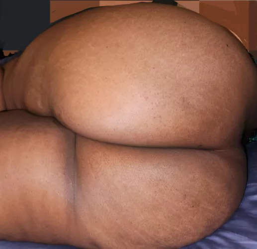 Are these stretch marks ok