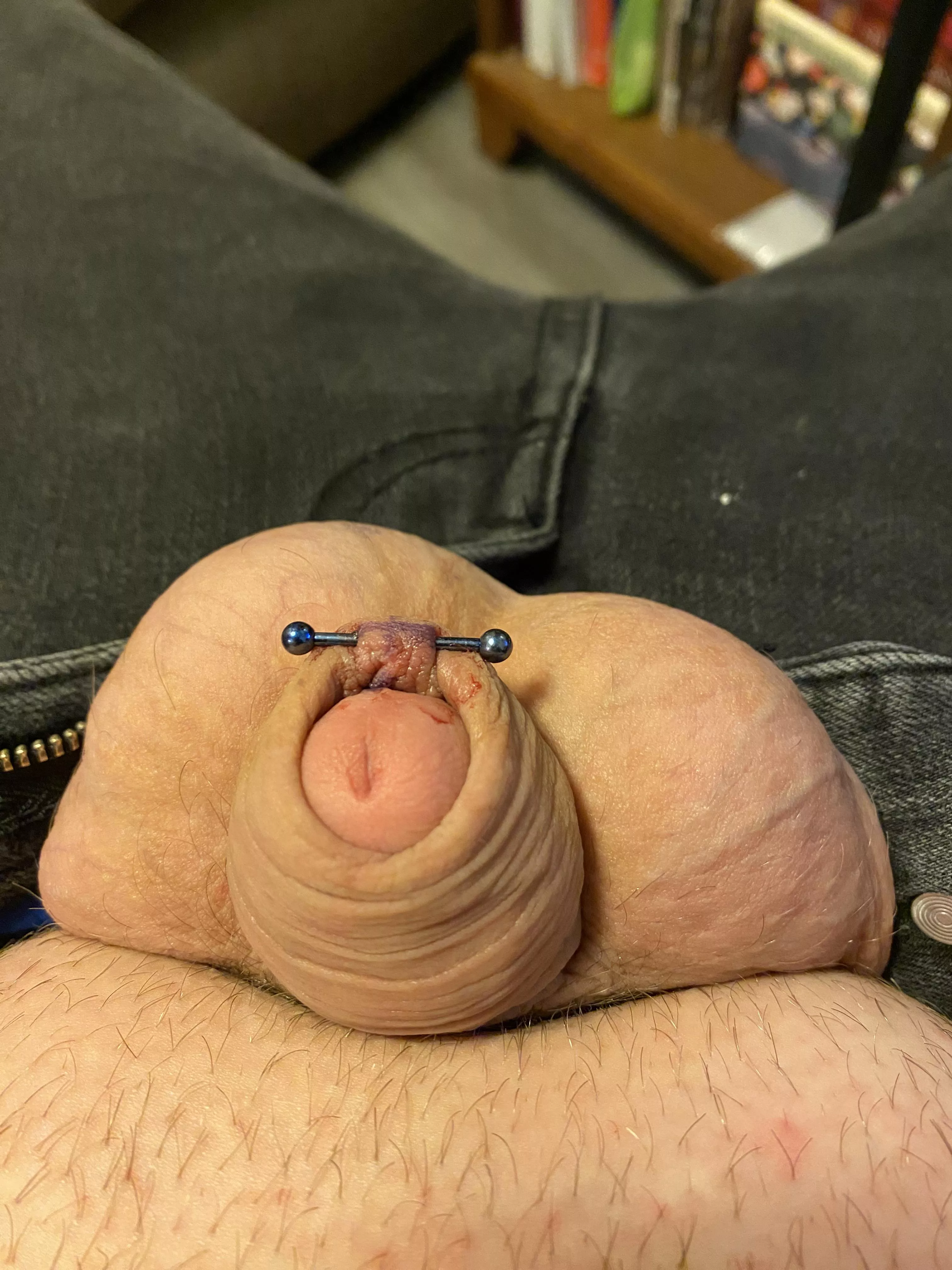 Fresh (less than an hour) old frenulum piercing!