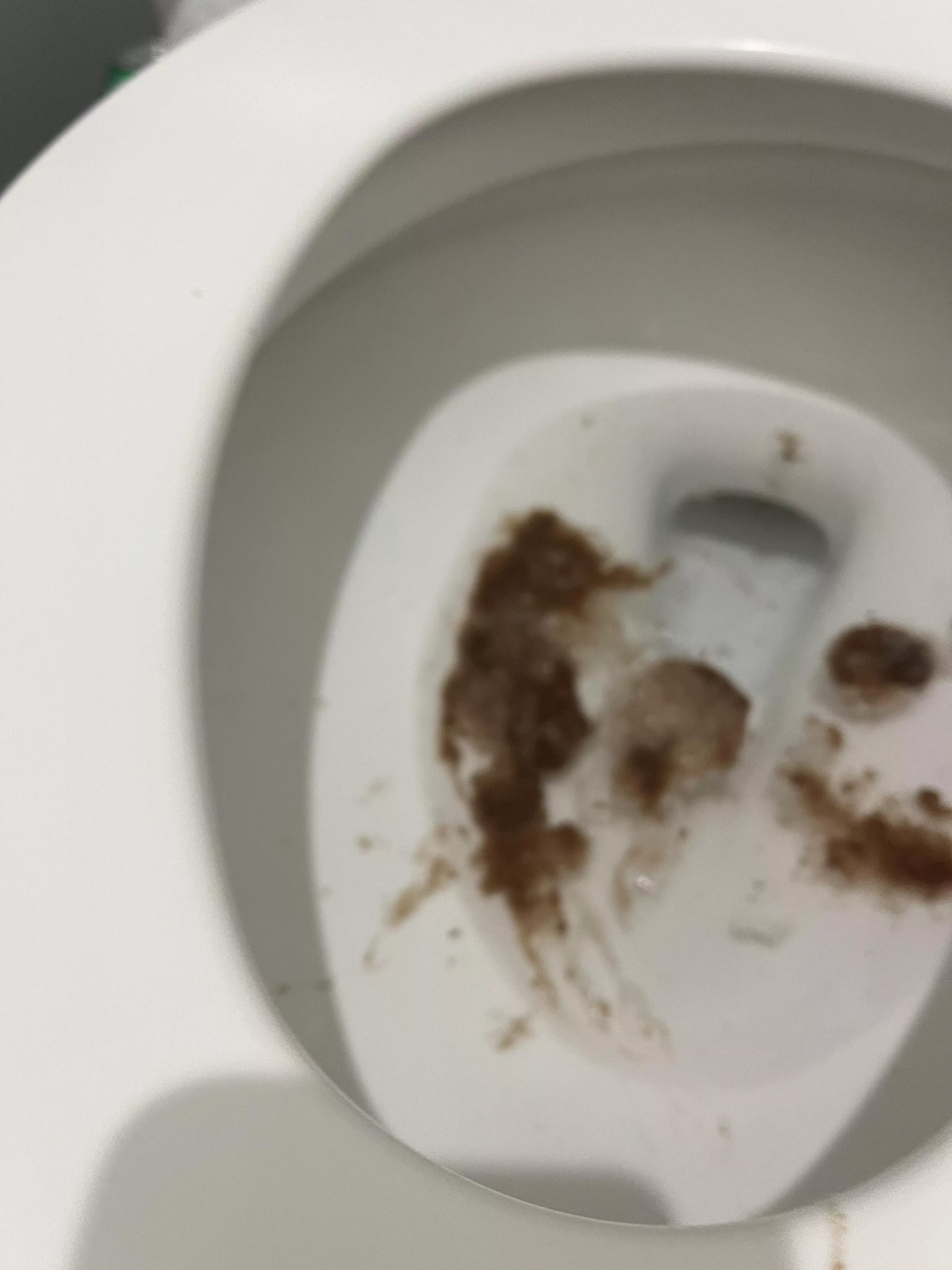 Is brown vomit normal ? I’m having bad stomach pains and headache 