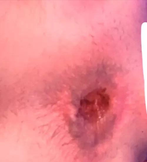 my ass after i used my biggest toy for hours