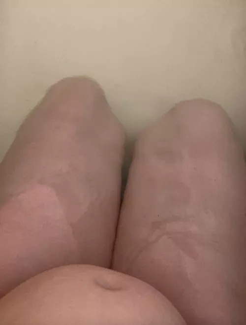 My boyfriend says he likes my stomach. Is it bad? 