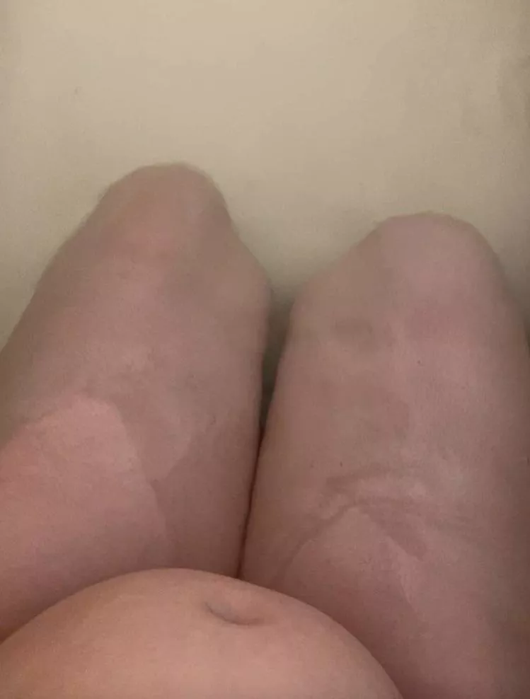 My boyfriend says he likes my stomach. Is it bad? 