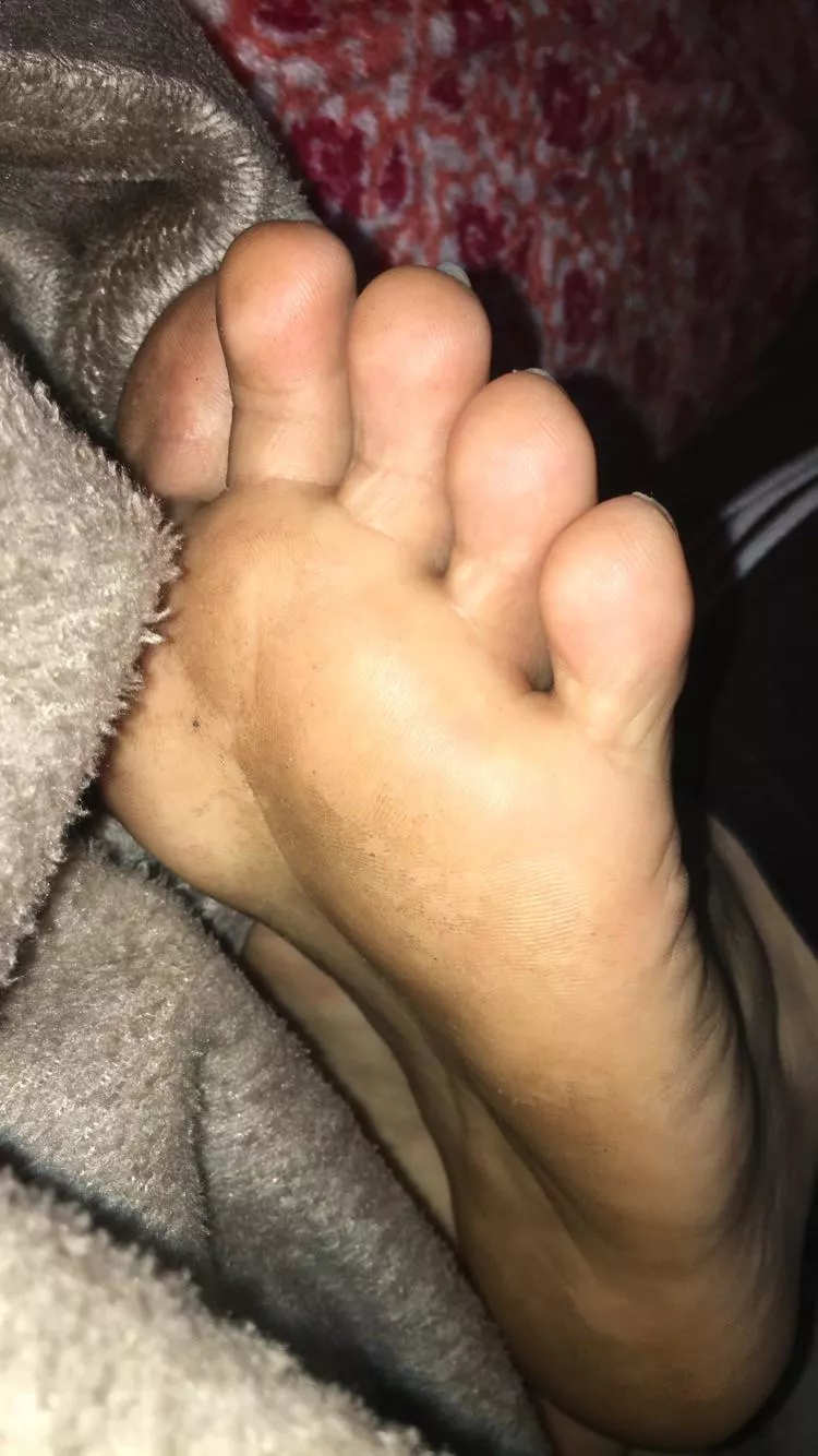 My feet after a 10 hour shift