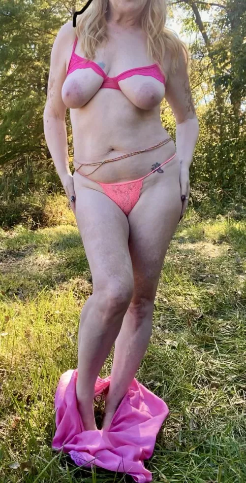 My pigment is gone from all of my tastiest bits. Wanna sample? 