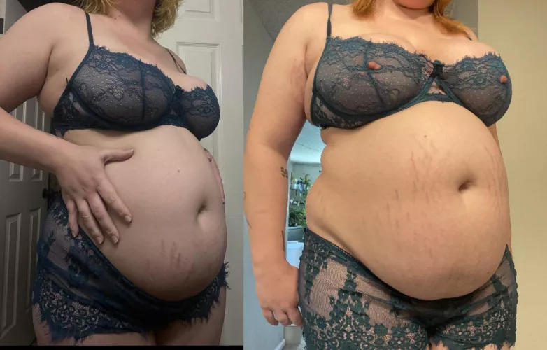 my stretch marks are taking over