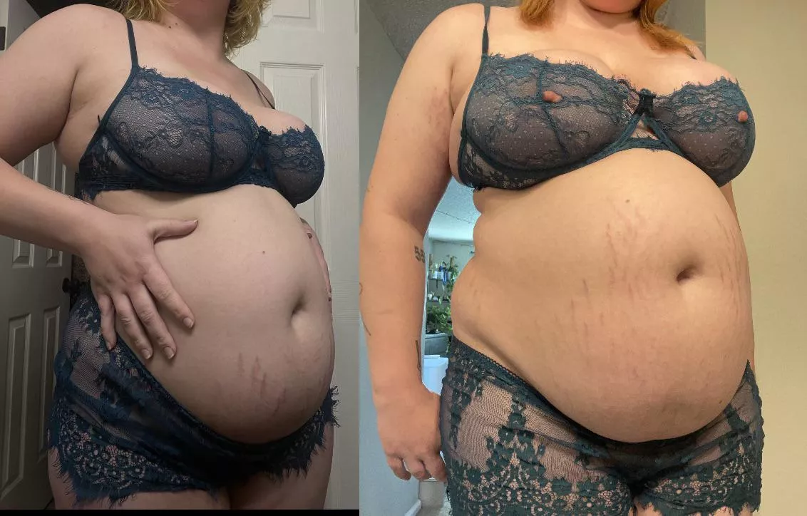 my stretch marks are taking over