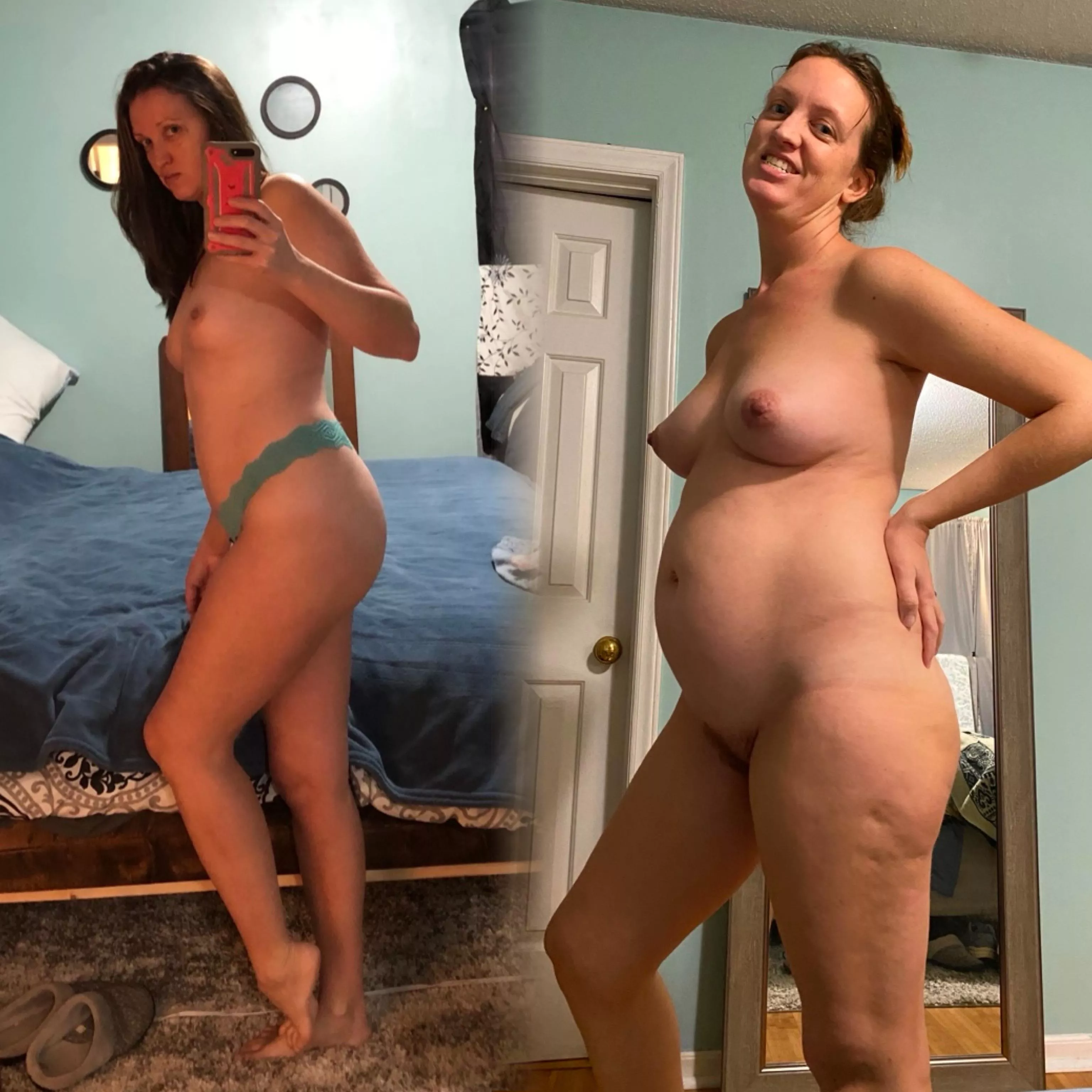 Before and after pregnancy 