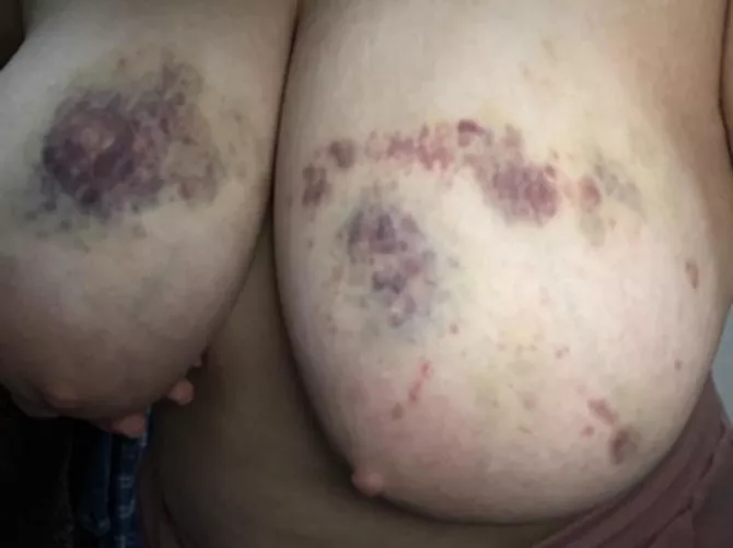 Can daddy bruise my F23 cervix like this? I want to break 